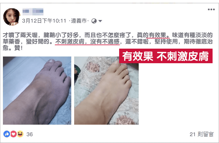 腱鞘炎藥膏